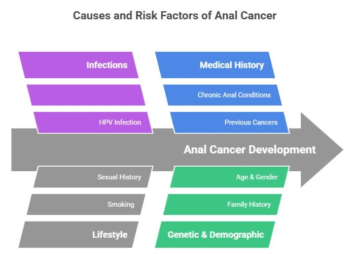 Causes of Anal Cancer